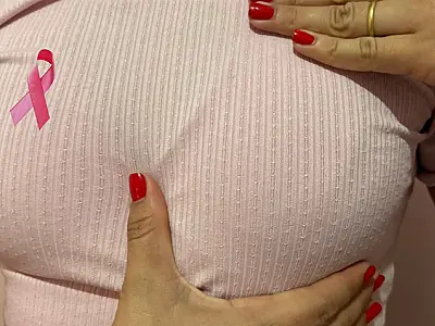 Câncer de mama é uma das principais causas de morte entre mulheres em Mato Grosso do Sul