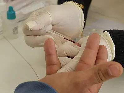 Procura por testes rápidos para sífilis aumenta 45,7% em Campo Grande