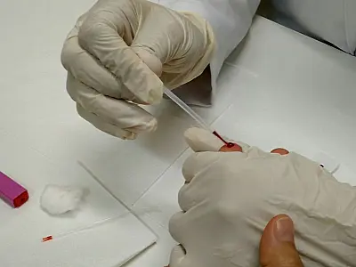 Metade dos jovens em Mato Grosso do Sul deve ser vacinada contra o HPV