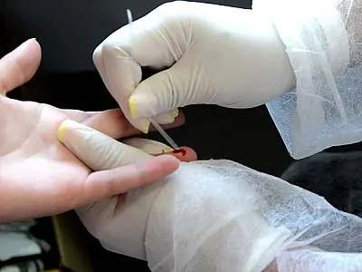 Mato Grosso do Sul é o sétimo estado com mais casos de Aids no Brasil