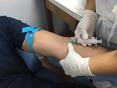Estudo indica 1.190 casos de câncer de próstata em Mato Grosso do Sul entre 2018 e 2019
