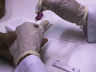 Mato Grosso do Sul registra um novo caso de Aids por dia