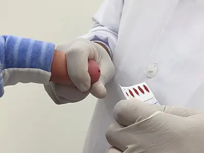 Falta de dados da rede privada causa divergência na interpretação de pesquisa sobre teste do pezinho